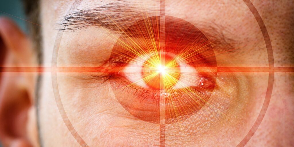 Auge