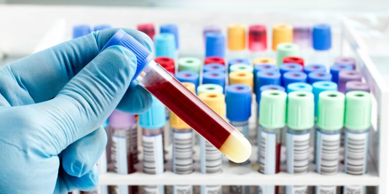 Studie: Hohe PFAS-Belastung macht anfälliger für Corona