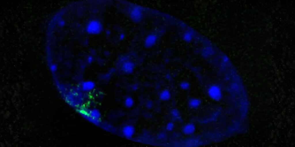 X-Chromosom
